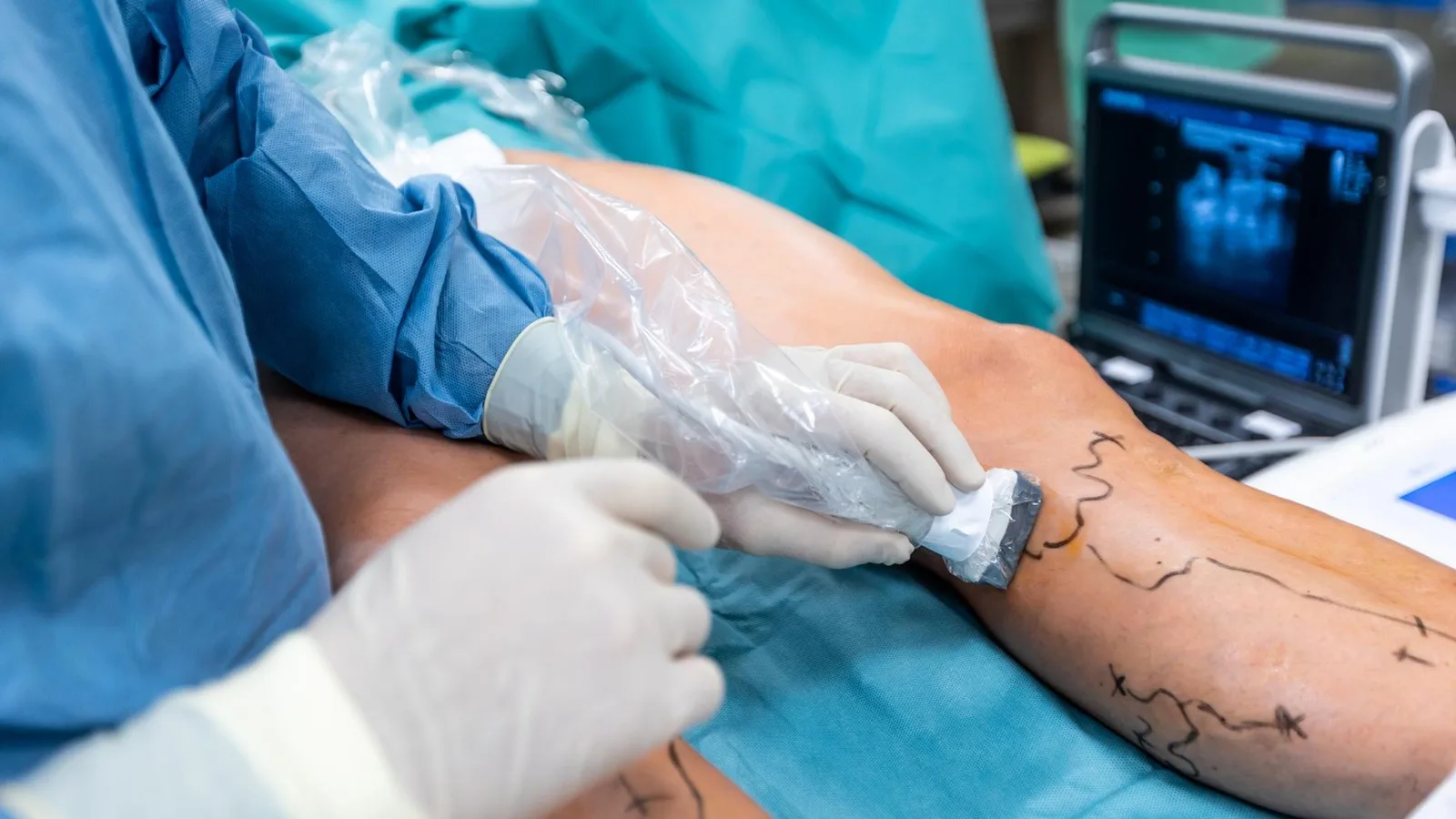 ¿Qué médico trata edema en piernas?