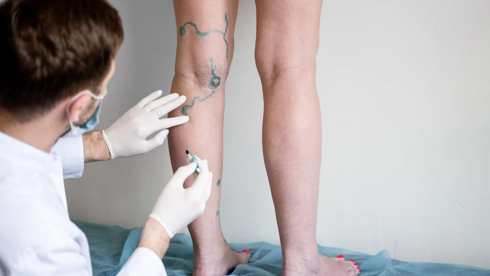 Abordaje integral de la enfermedad arterial periférica en CDMX