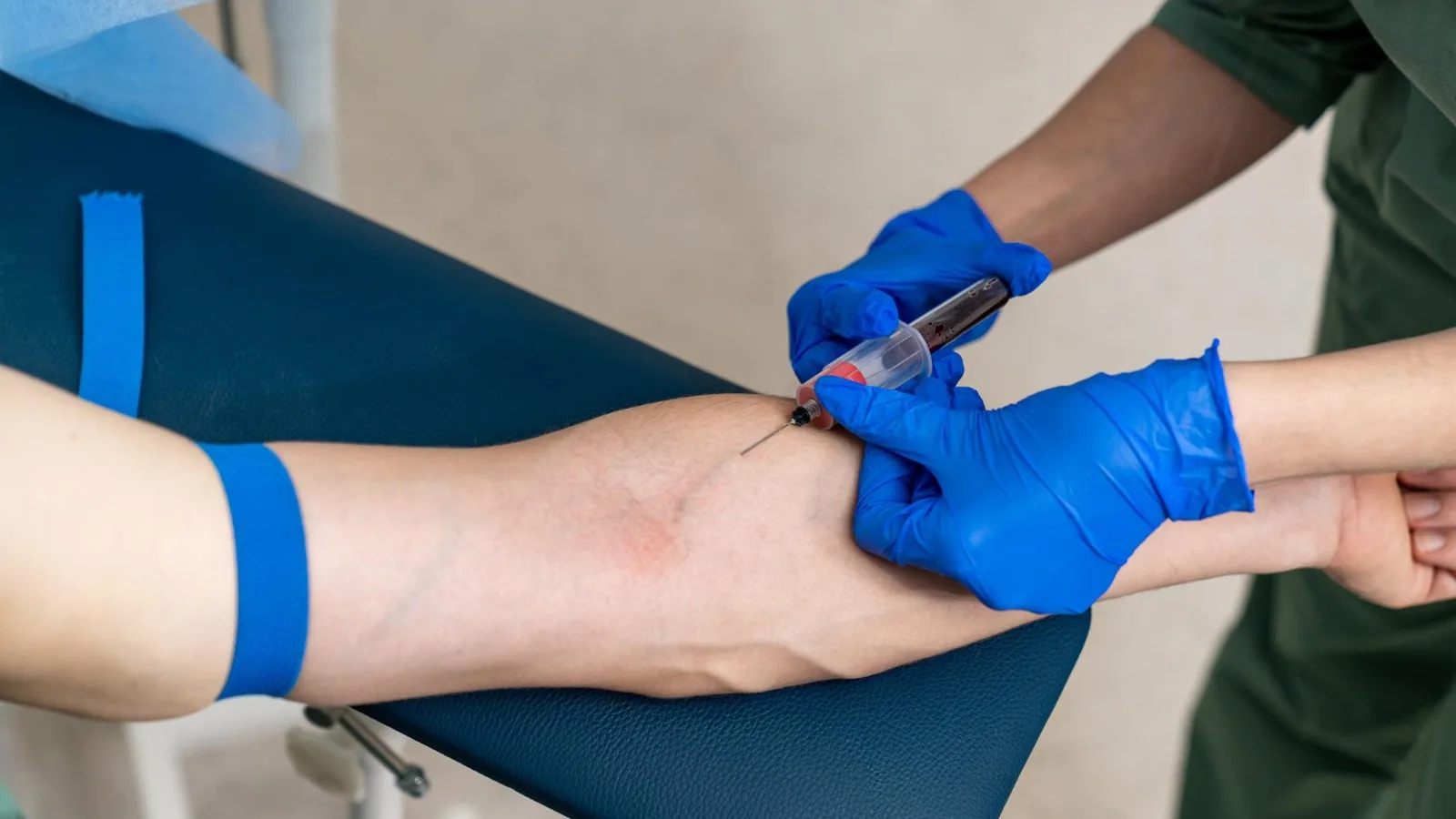 ¿Qué médico trata isquemia de extremidades?