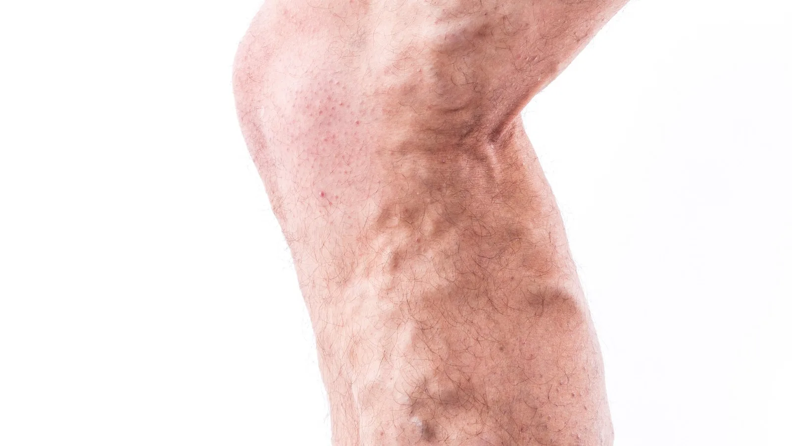 Especialista en malformaciones vasculares en la CDMX