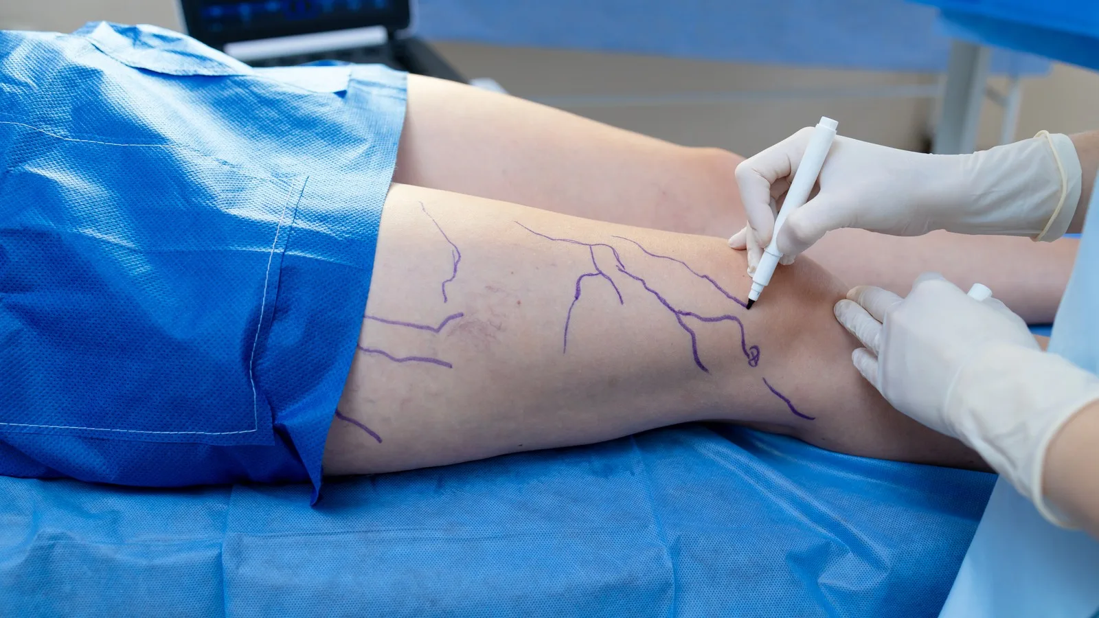 Especialista en problemas de circulación en CDMX