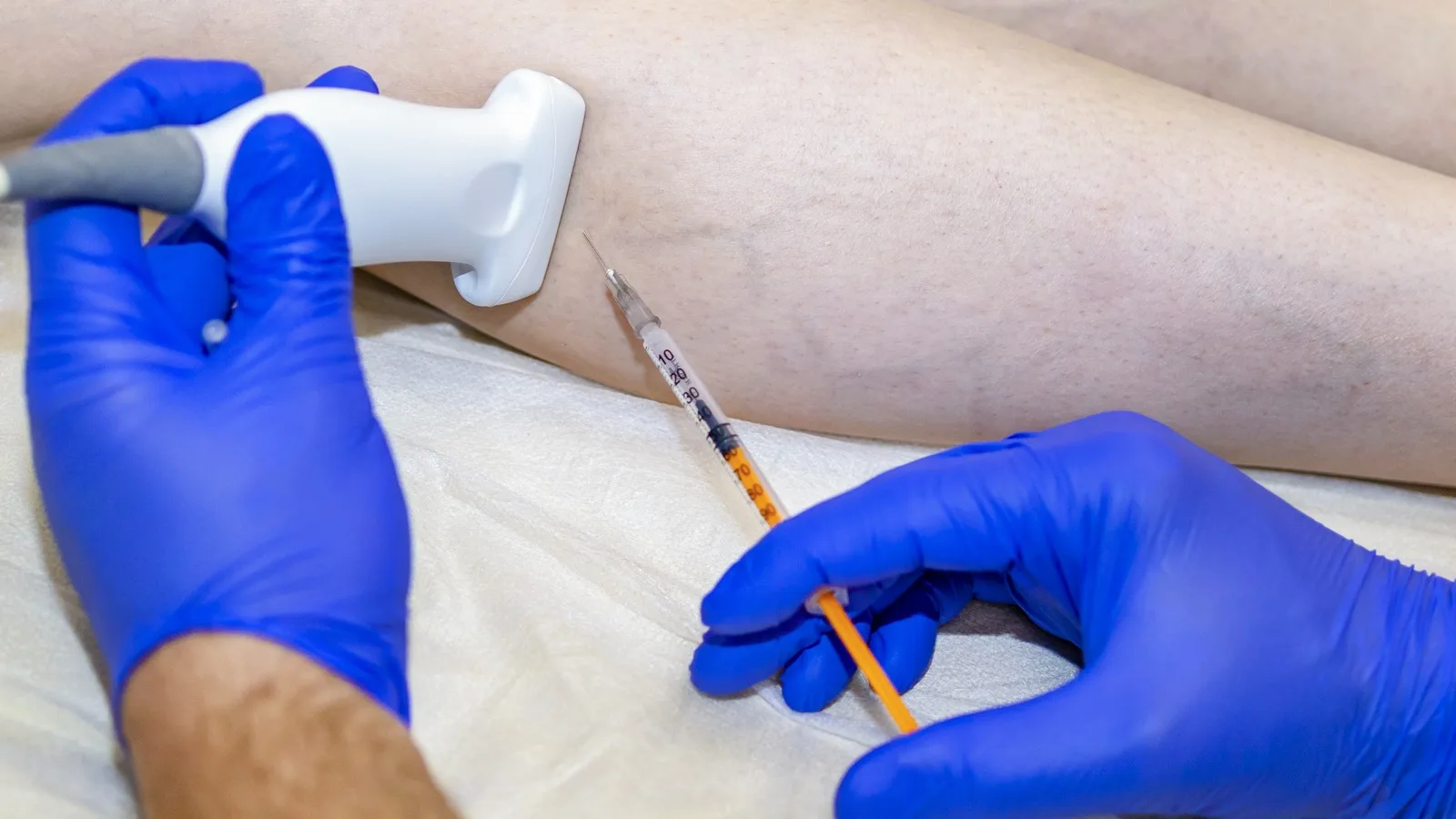 ¿Qué médico trata tromboflebitis?